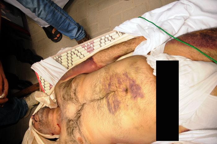 File:Abdulkarim Ali Ahmed Fakhrawi body with torture marks 11.jpg