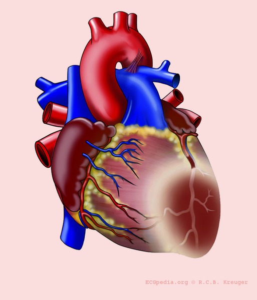 File:De-Heart with AL infarct (CardioNetworks ECGpedia).png