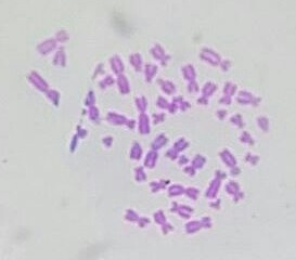 Micrografía dos cromosomas dun varón con tinguidura Giemsa na que se observan as bandas G.