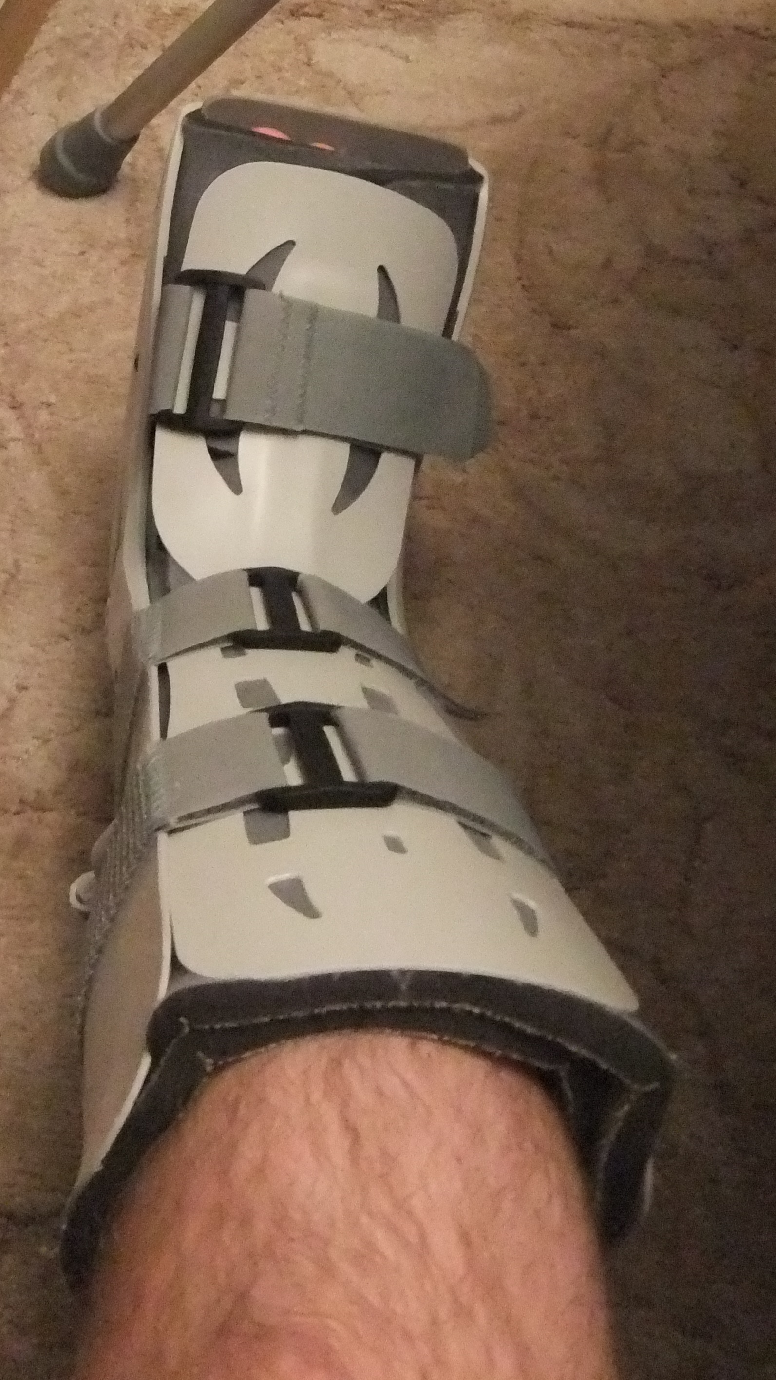 The Walking Boot: Everything You Need to Know - BEK Medical