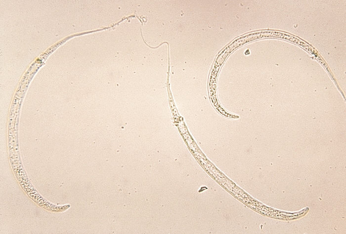 File:Dracunculus medinensis larvae.jpg