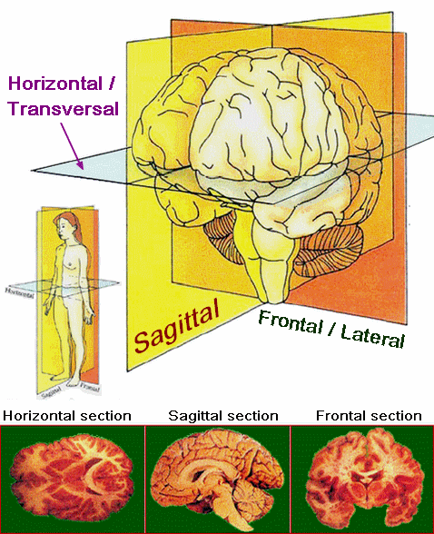 File:AxesAnatomieCerveau.png