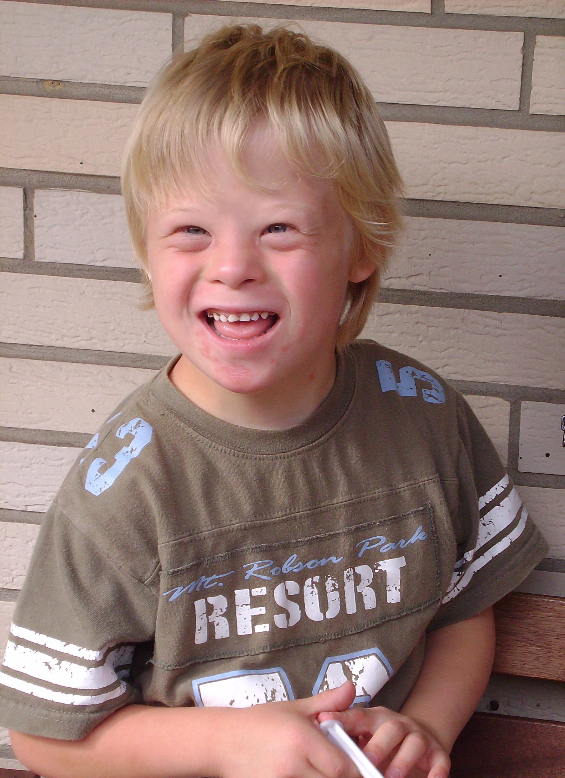 File Boy With Down Syndrome JPG Wikimedia Commons