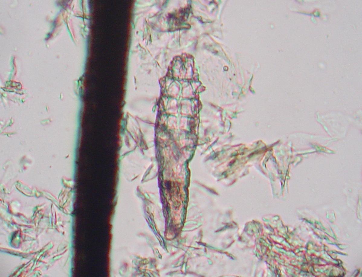 Filedemodex Mite 1 Wikipedia