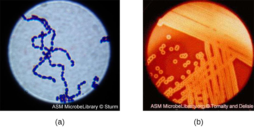 File:Staphylococcus aureus Gram stain.jpg - Wikimedia Commons