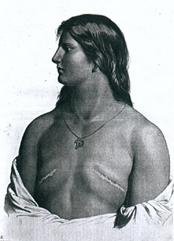 File:A young woman, taken by surprise, covers her breasts. Wellcome  L0074555.jpg - Wikimedia Commons