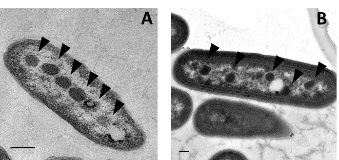 File:Alpha and beta carboxysomes.jpg