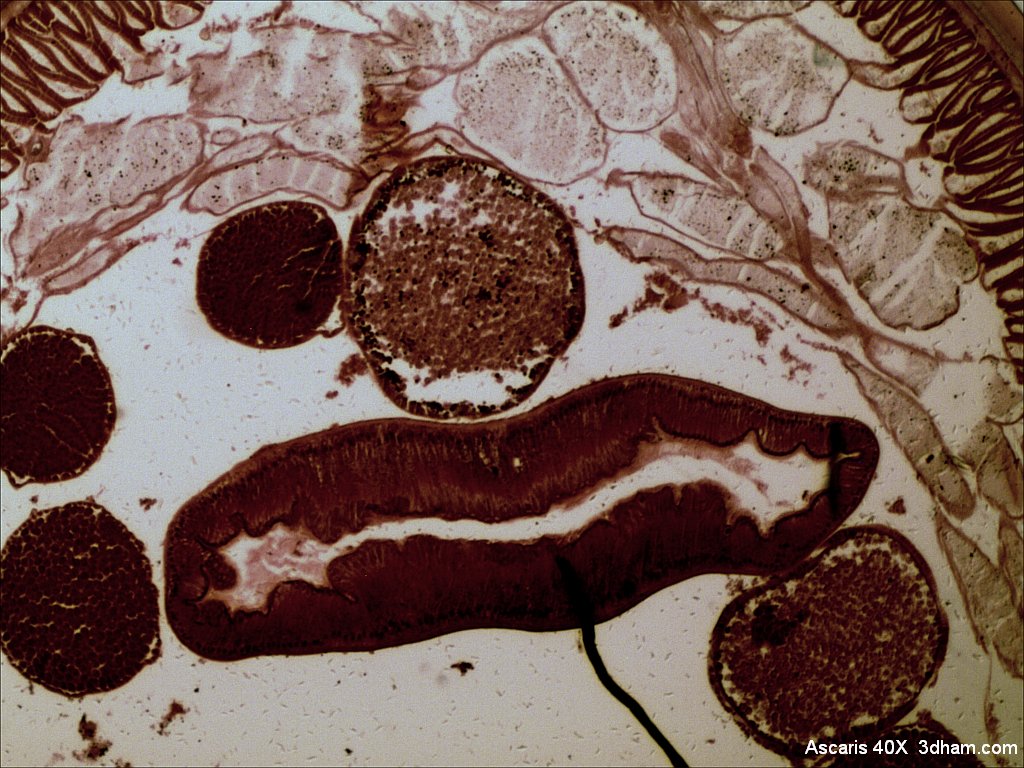 Аскариды у детей фото под микроскопом