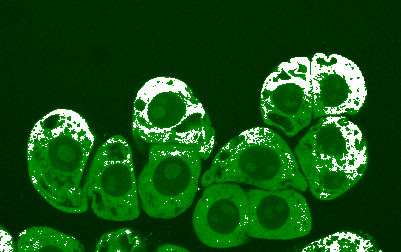 File:The production and diffusion of nitric oxide (NO) (white) in the cytoplasm (green) of clusters of conifer cells one hour after mechanical agitation.jpg