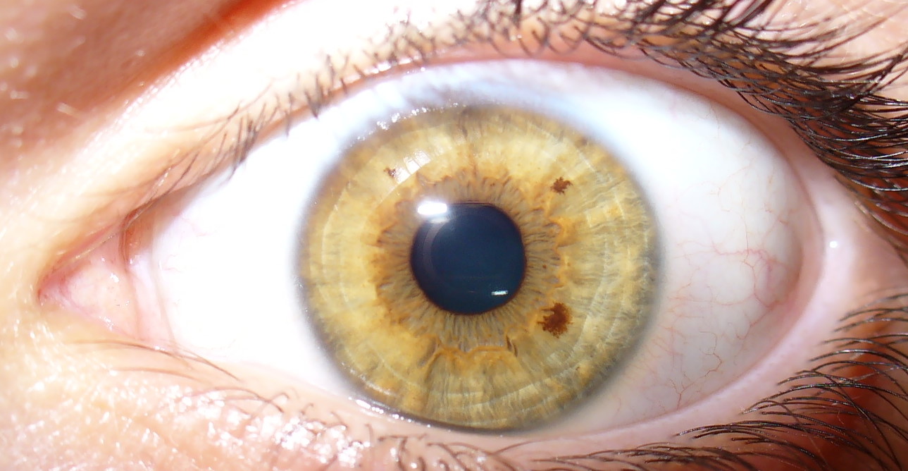 Eye color - Wikipedia