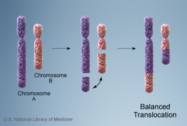 File:Balanced translocation.jpg