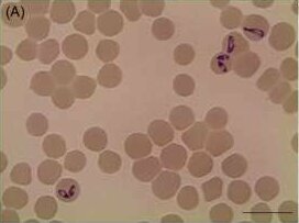 Babesia caballi