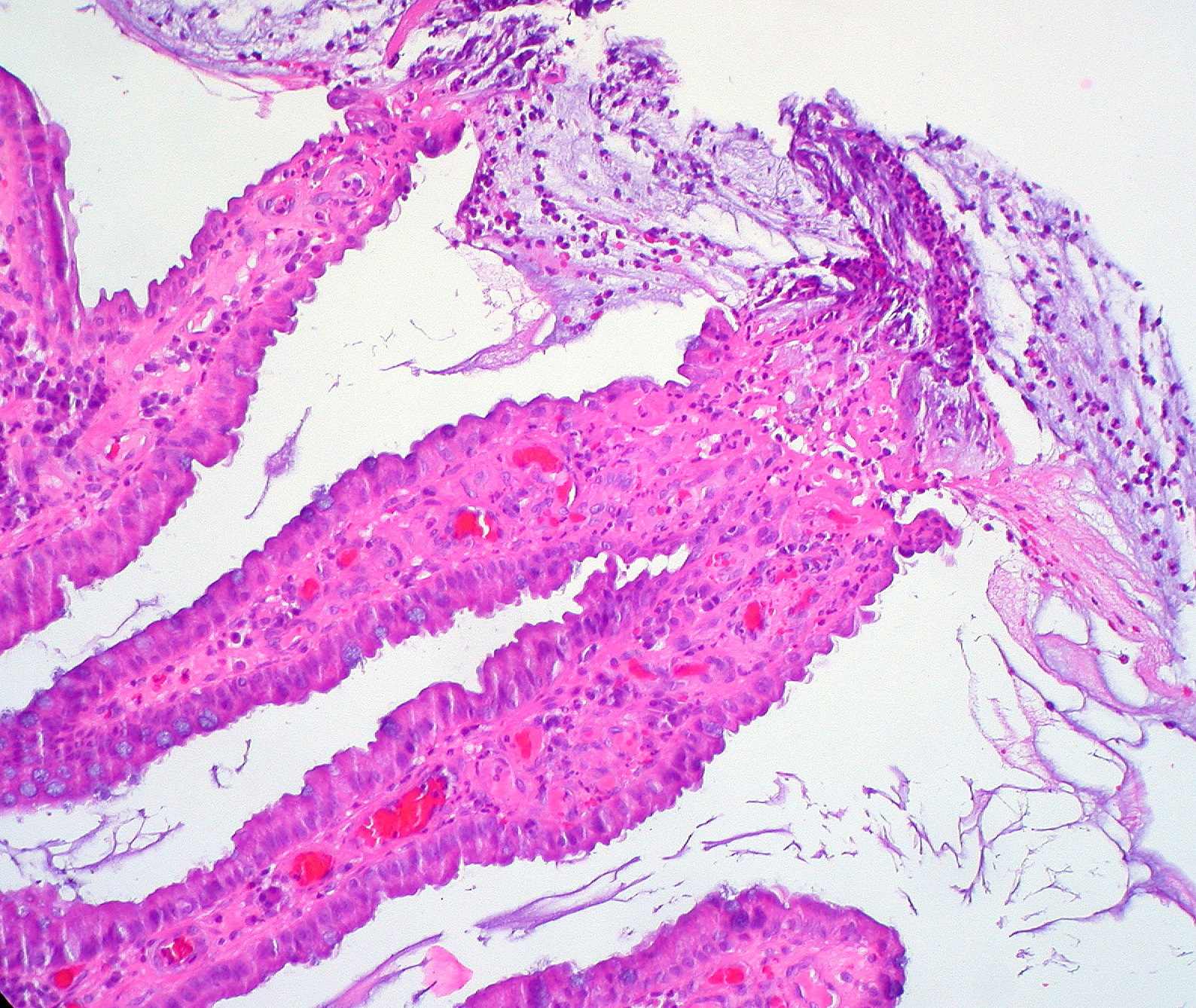 The file mapisvc inflammatory disease