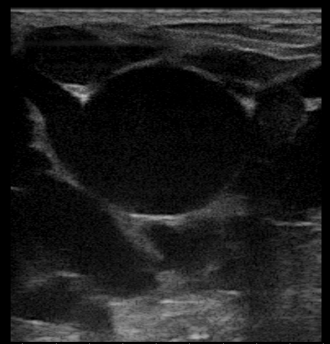 File:Ultrasound Scan ND 115254 1155360 cr.png