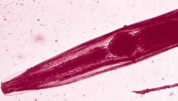 pinworm latin