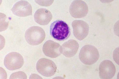 Small_lymphocyte-2.jpg