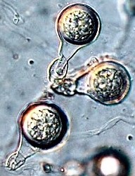 Oospores of Phytophthora agathidicida 10554 oospore.jpg