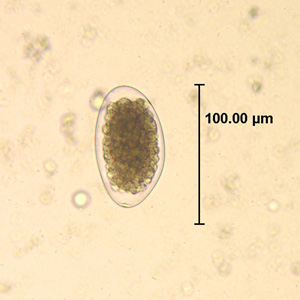 <i>Trichostrongylus</i> Genus of roundworms