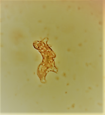 File:BeautifulTardigrade.png