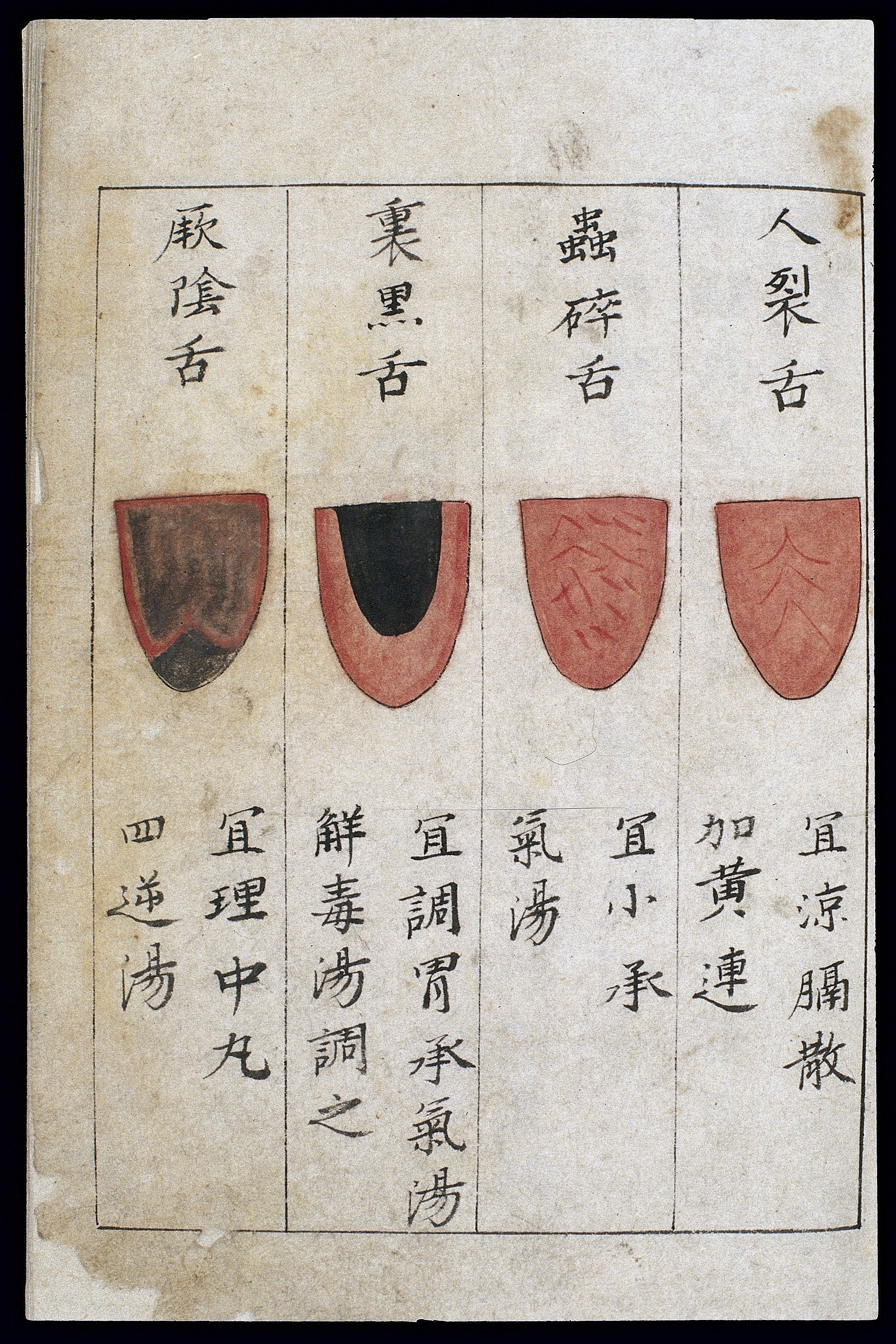 Tongue Diagnosis Tcm Chart