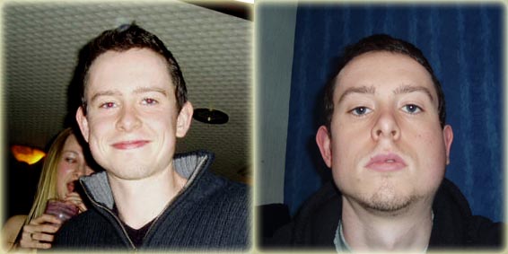 File:Mumps comparison.jpg