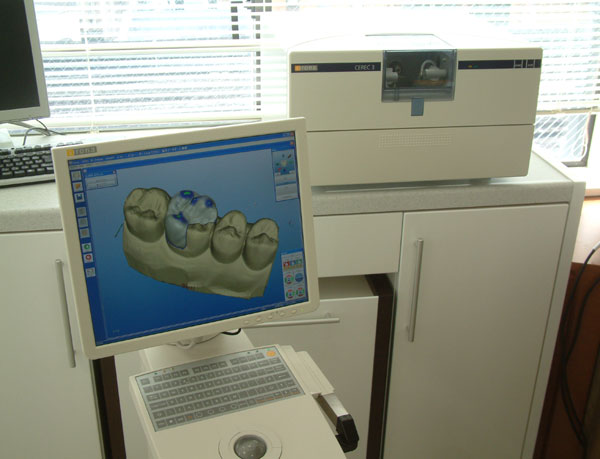 File:Cerec 59.jpg