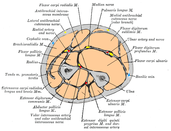 File:Gray417 color.PNG