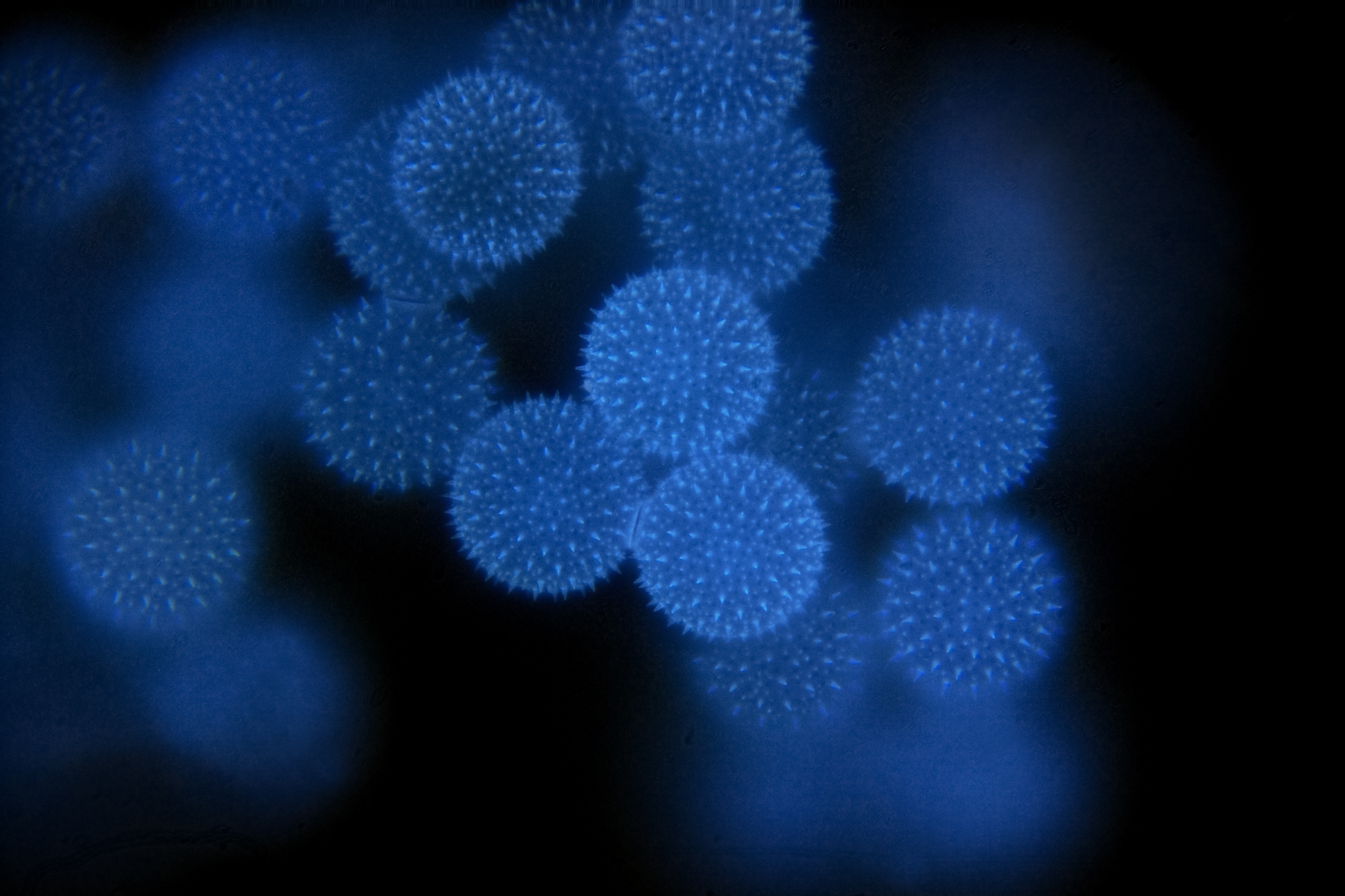 Гены пыльцы. Пыльца мальвы. Пыльца мальвы под микроскопом. Пыльца ромашки под микроскопом. Пыльца растений под микроскопом.