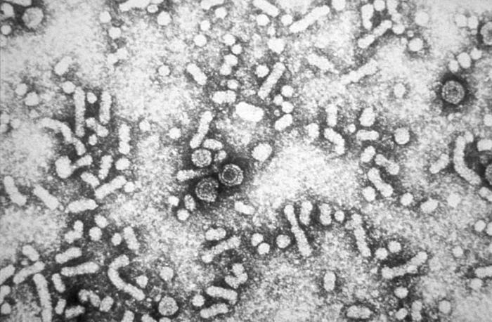 Mikroskopowy obraz wirusa HBV Wirusowe zapalenie wątroby typu A, B, C