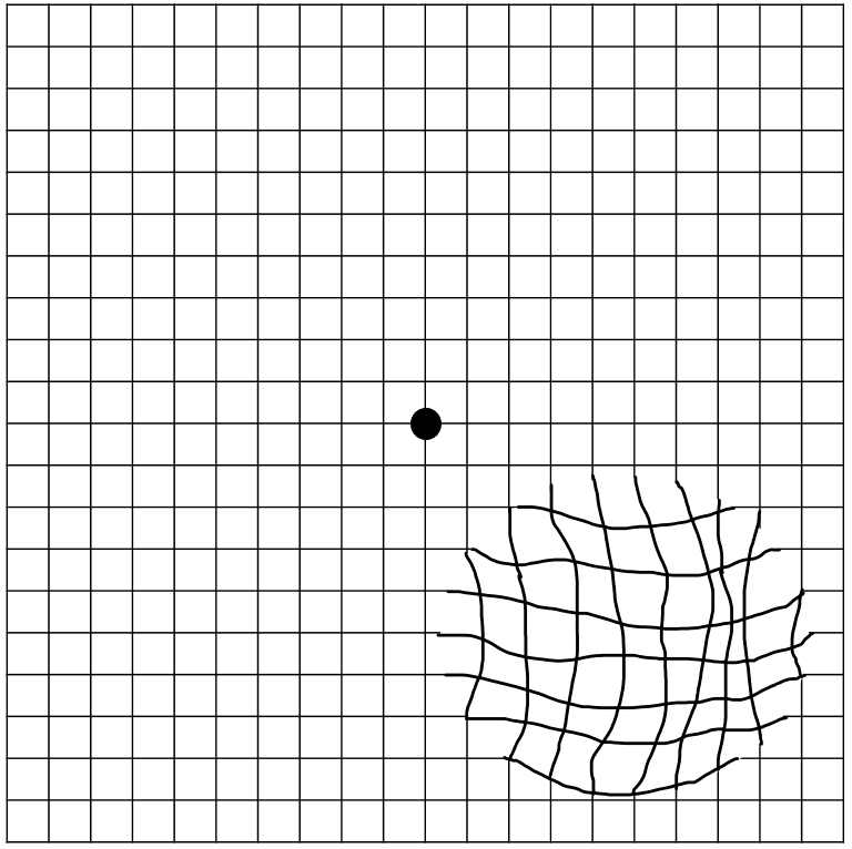 Amsler grid - Wikipedia