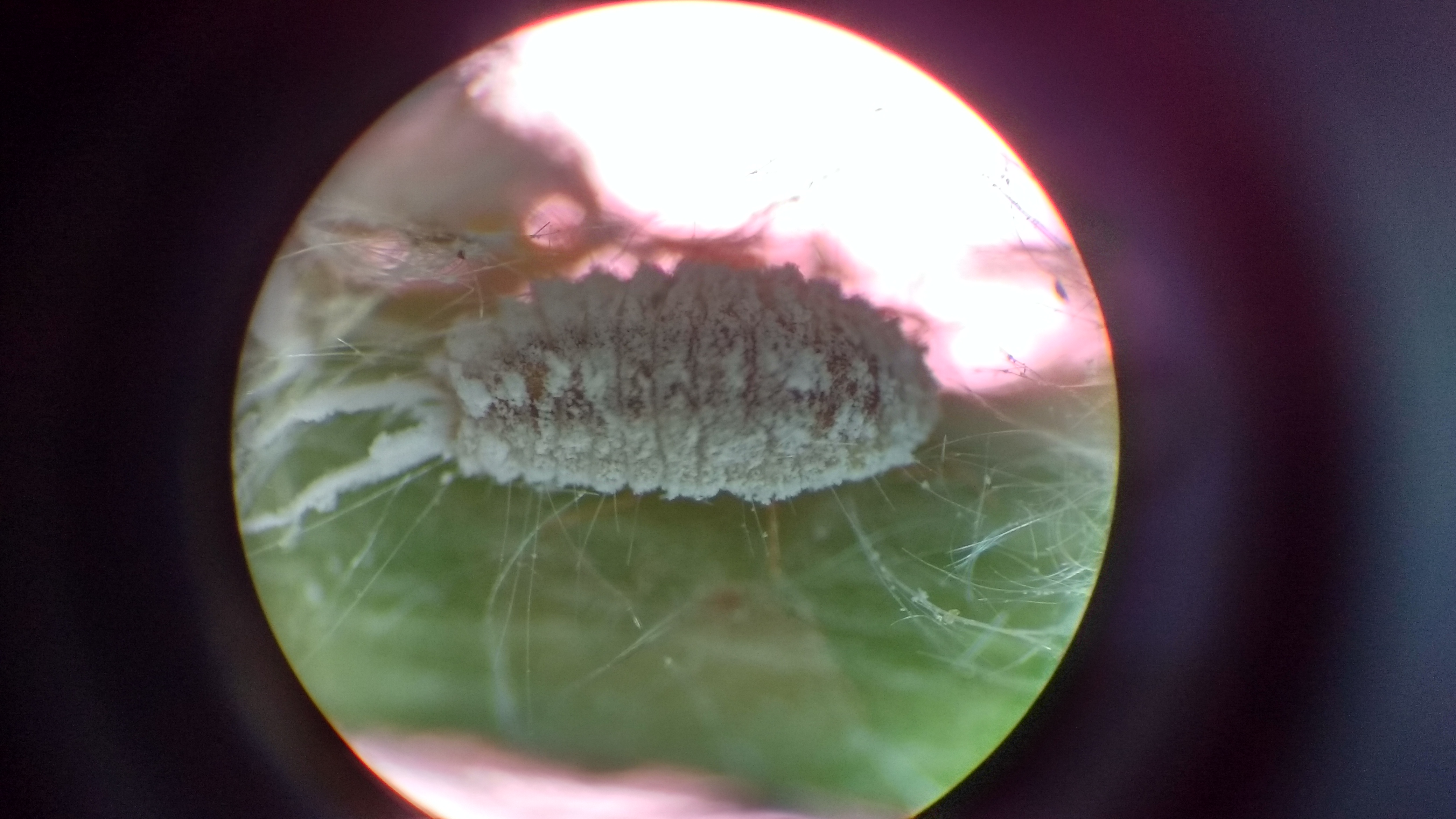 microscopic dust mites