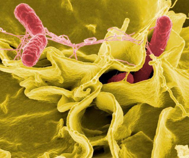 File:Salmonella Bacteria (5613656967).jpg