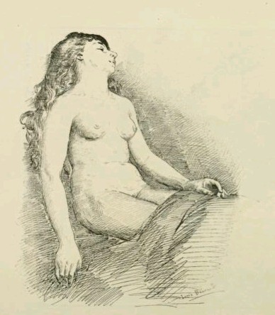 File:Nipple slip.jpg - Wikimedia Commons
