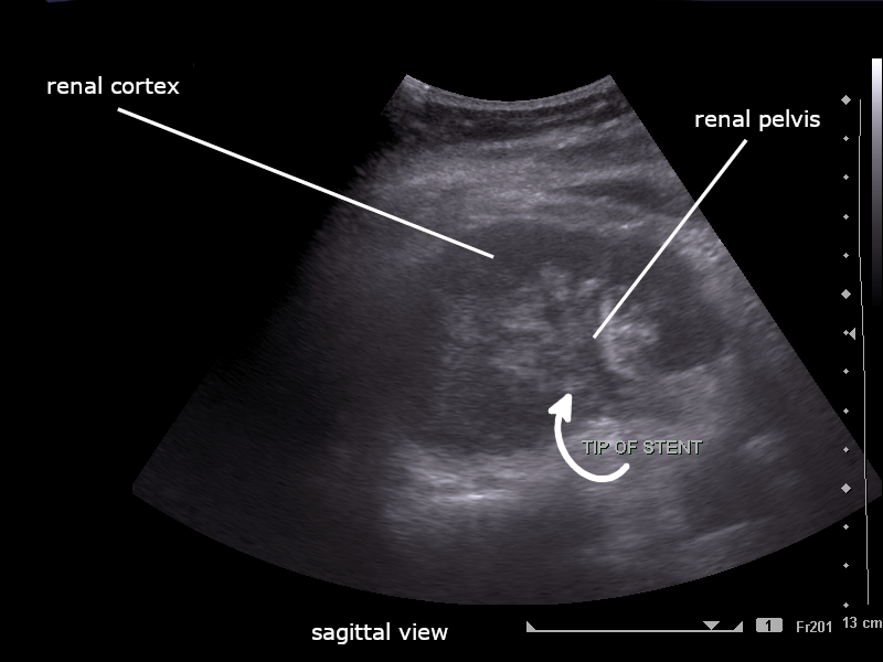 Renal cortex - Wikipedia