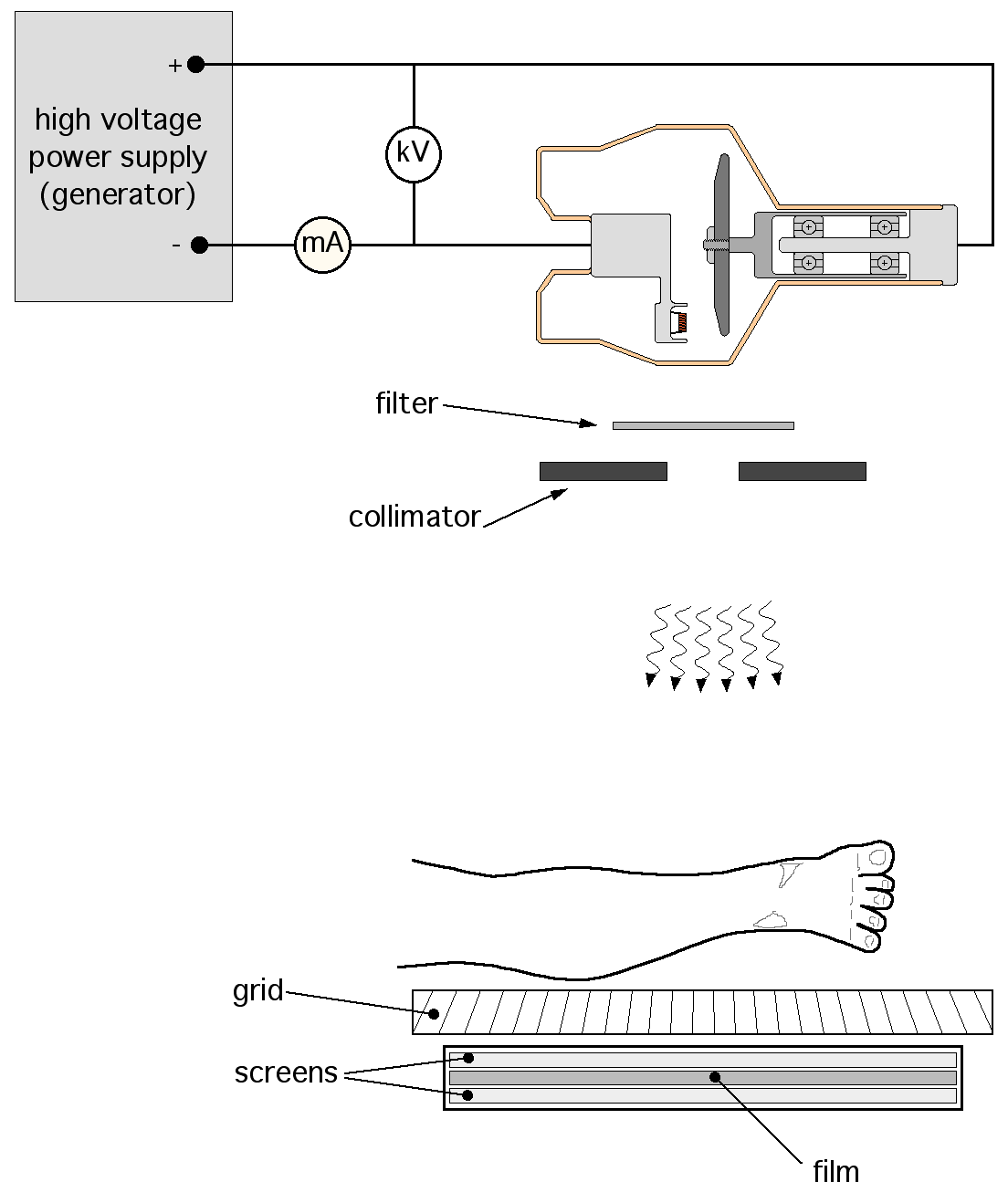 drawing of an x ray tube and collimator schematic