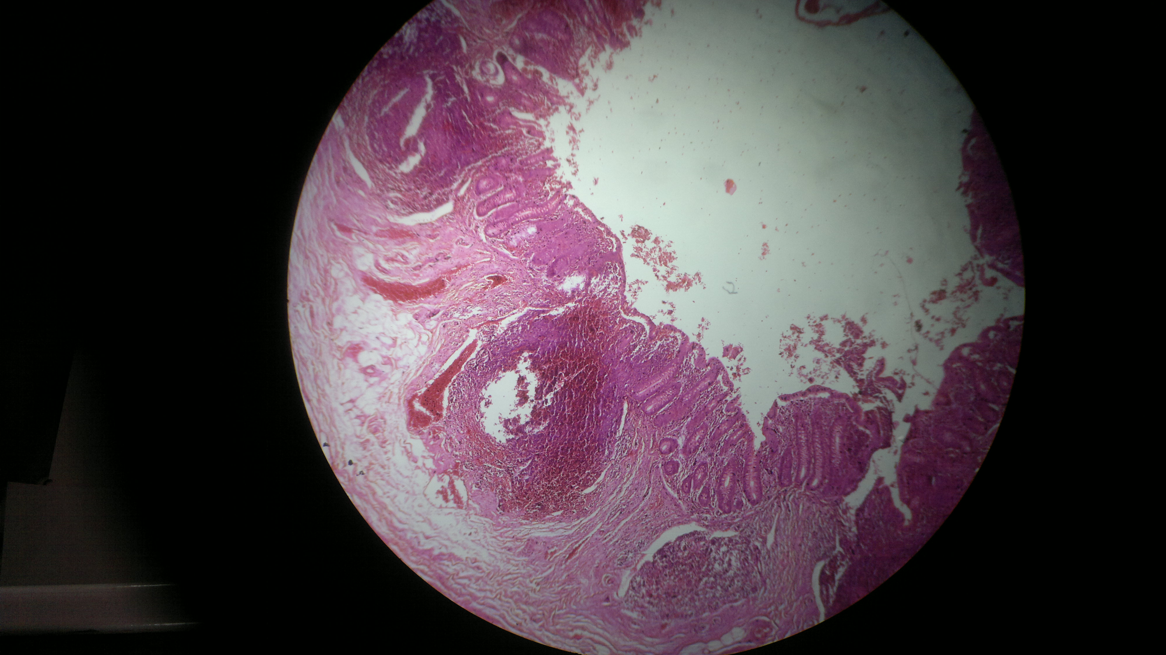 File:Histology of human appendix.jpg - Wikimedia Commons