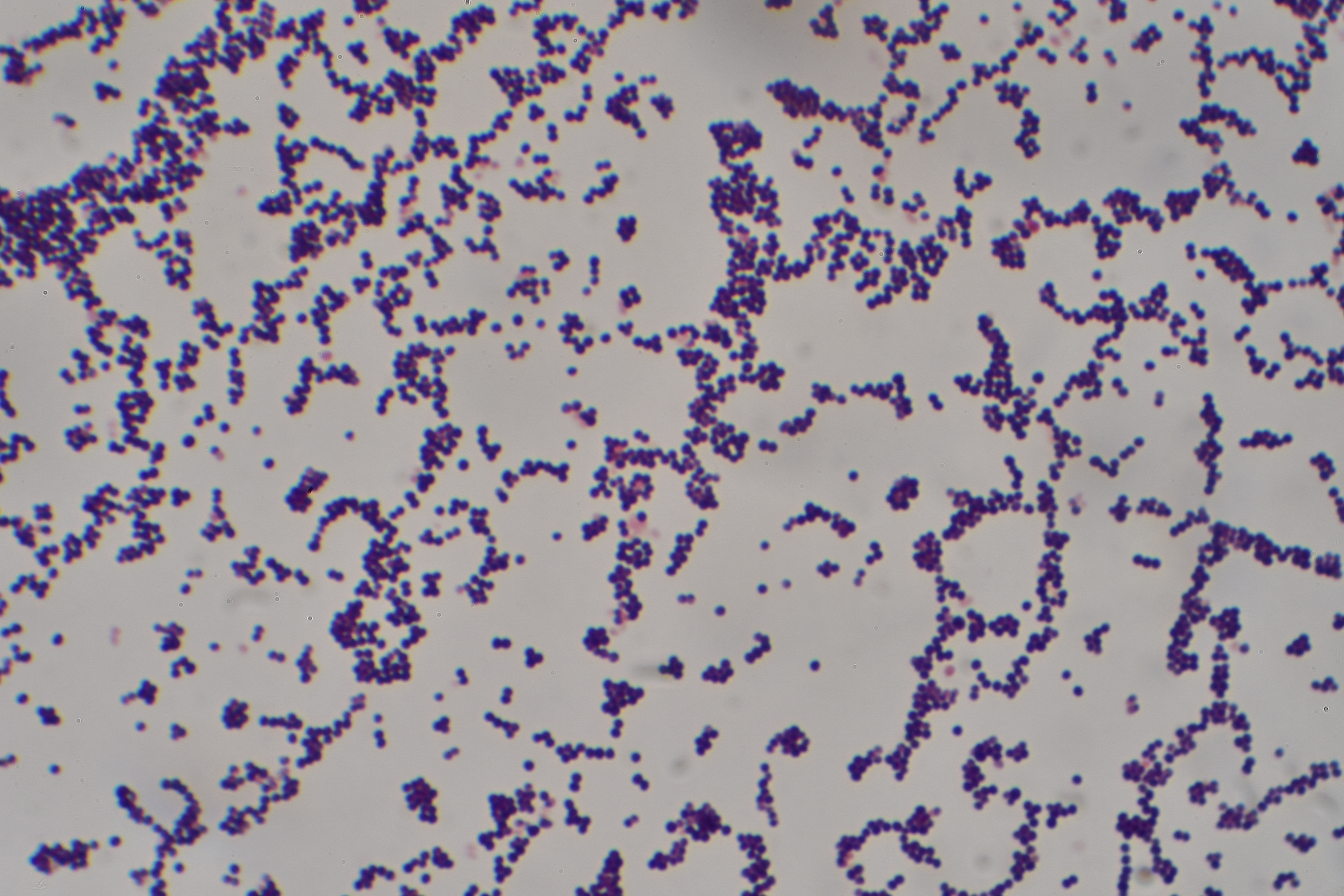 Staphylococcus aureus morphology visualised using Gram staining (10×