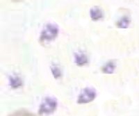 File:Blood platelets.jpg