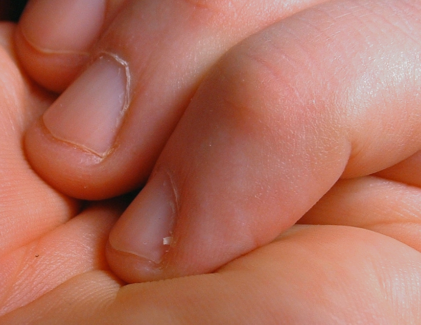 How to Stop Your Cuticles From Cracking and Peeling After a Manicure