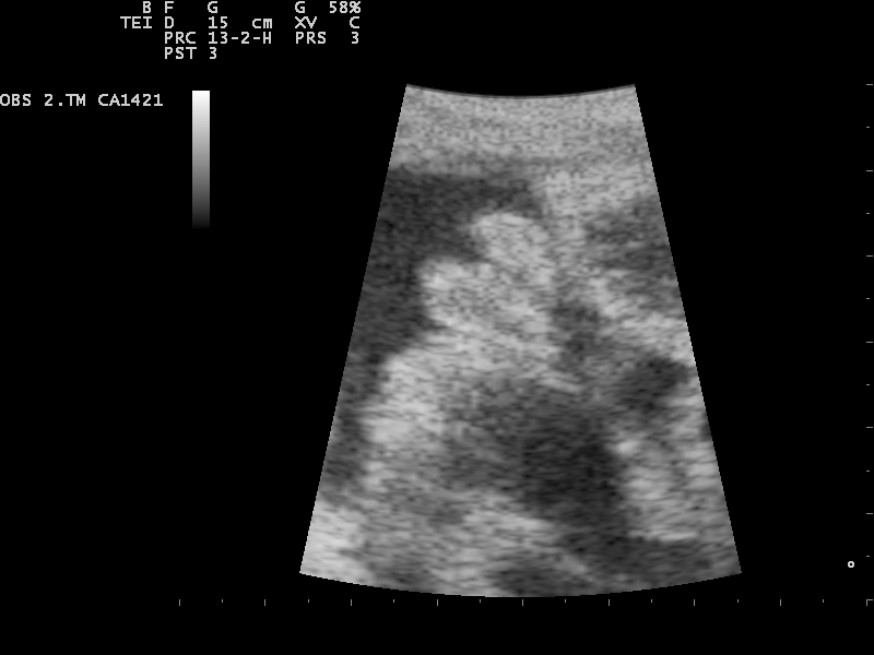 File:Ultrasound Scan ND 0125122532 1231430.png