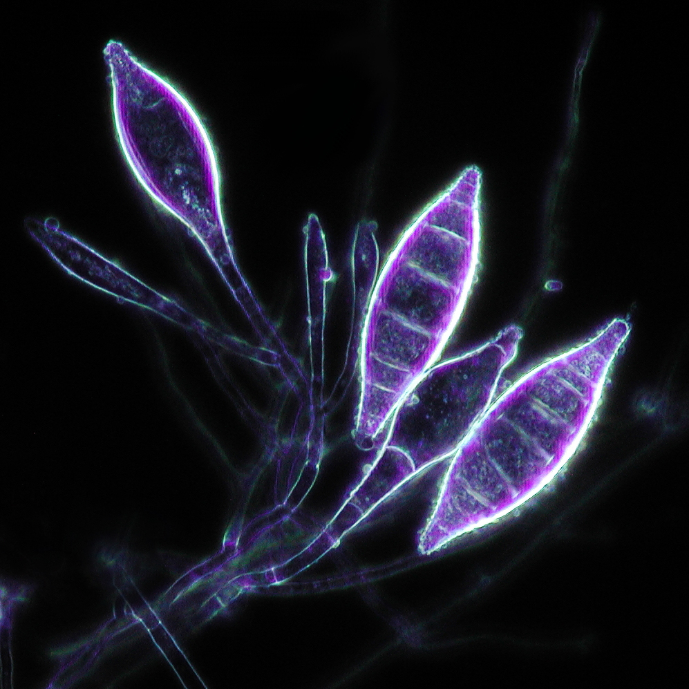 Microsporum canis. Микроспорум Канис. Microsporum canis микроспория. Макроконидии Microsporum audouinii.