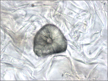 File:Plant cell type sclerenchyma sclereid.png