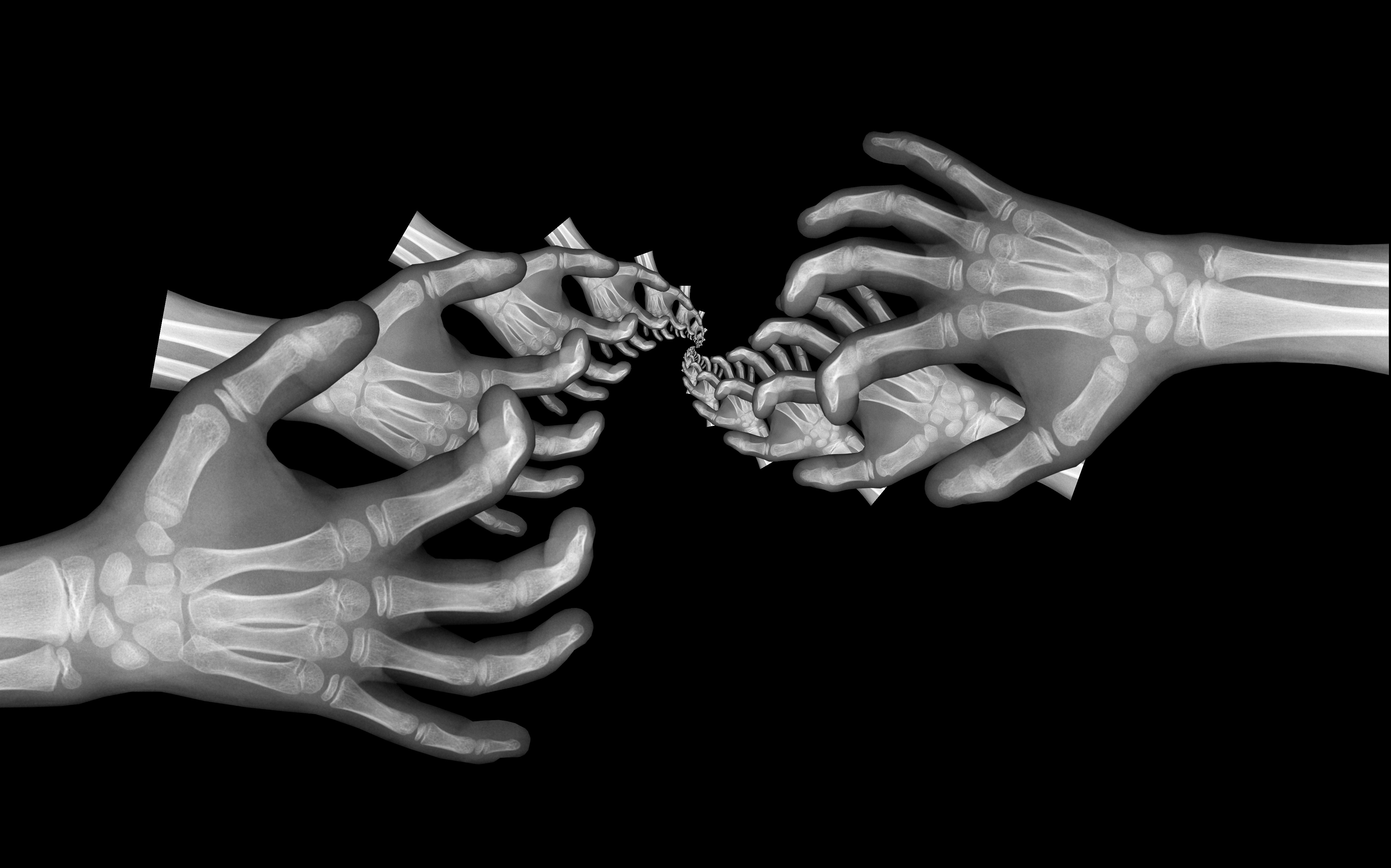 File:Hand X ray droste effect 02.jpg - Wikimedia Commons