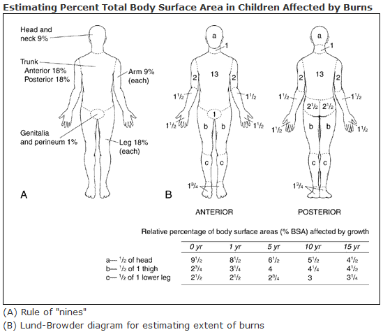 Infant Burn Chart