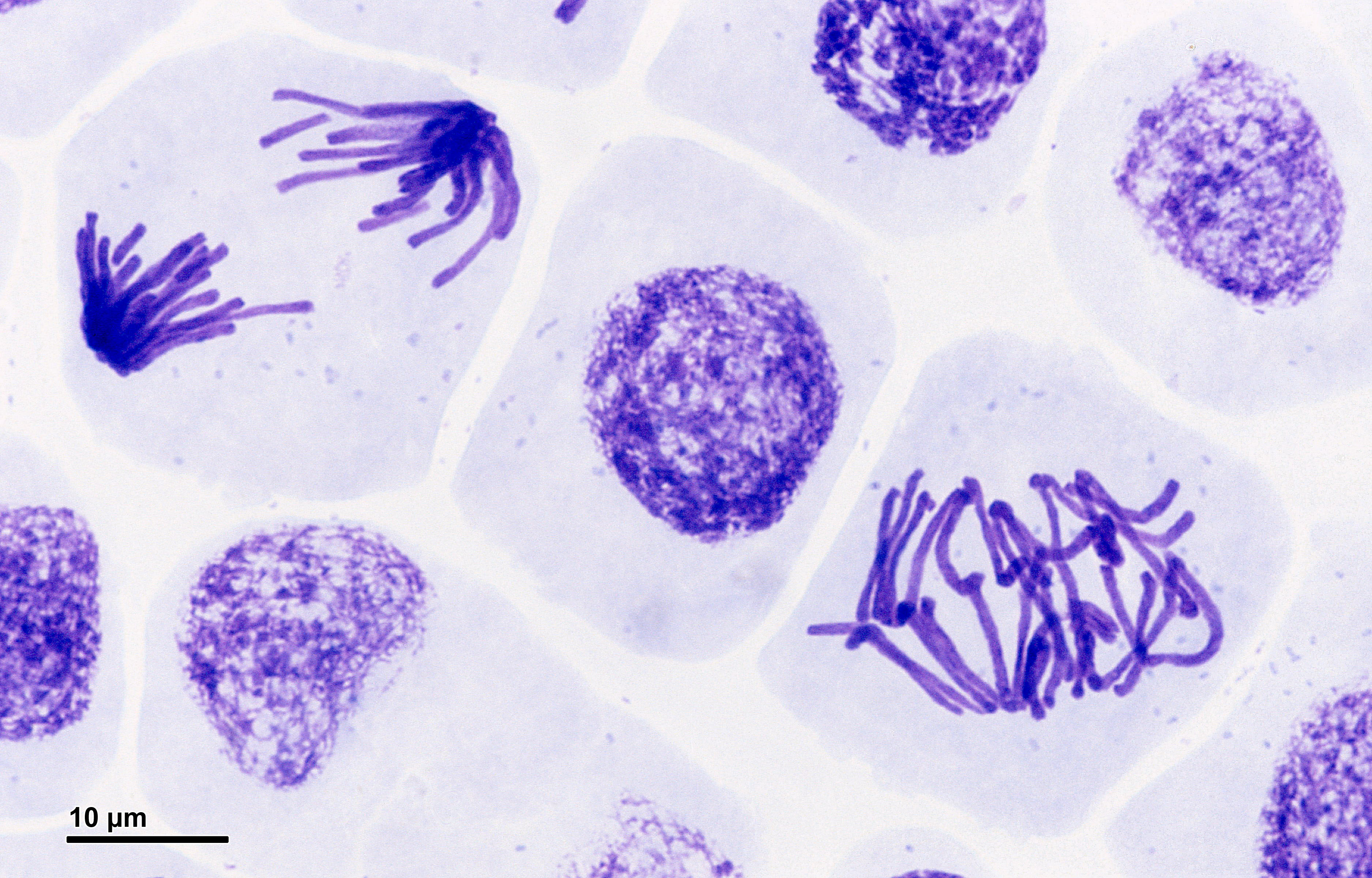 Microscope images of root cells in anaphase and prophase showing chromosomes stained purple