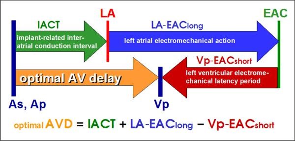 AV-Delay Optimierung