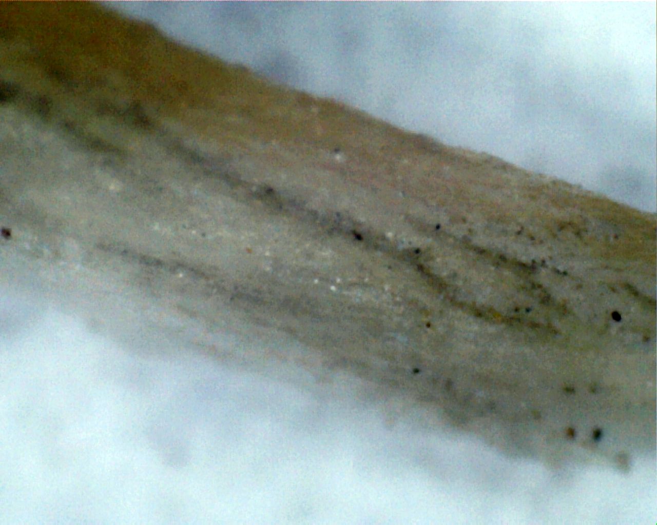 Nails under microscope | الأظافر تحت المجهر #microscope #nature #trending  #tiktok #skincare #nails - YouTube