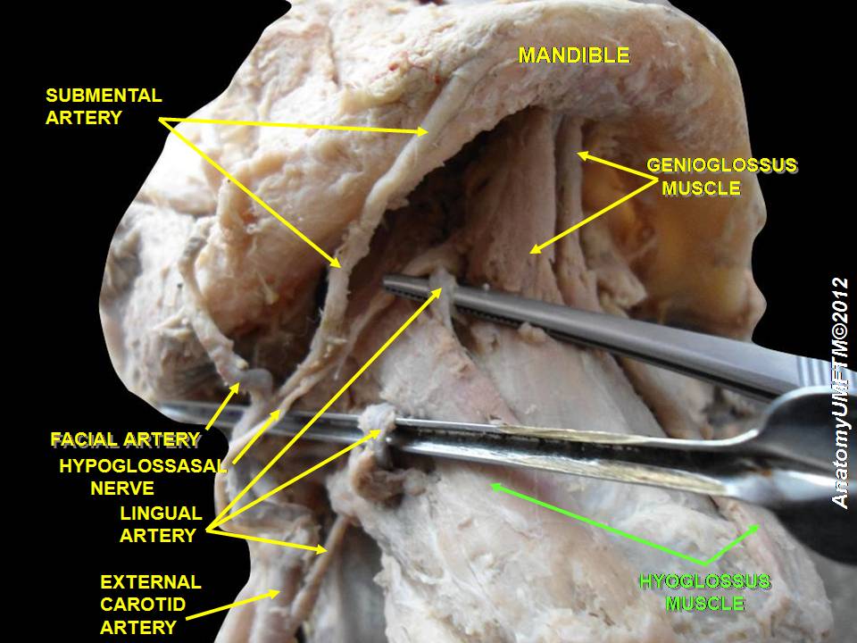 File:Mandibular nerve.jpg - Wikipedia