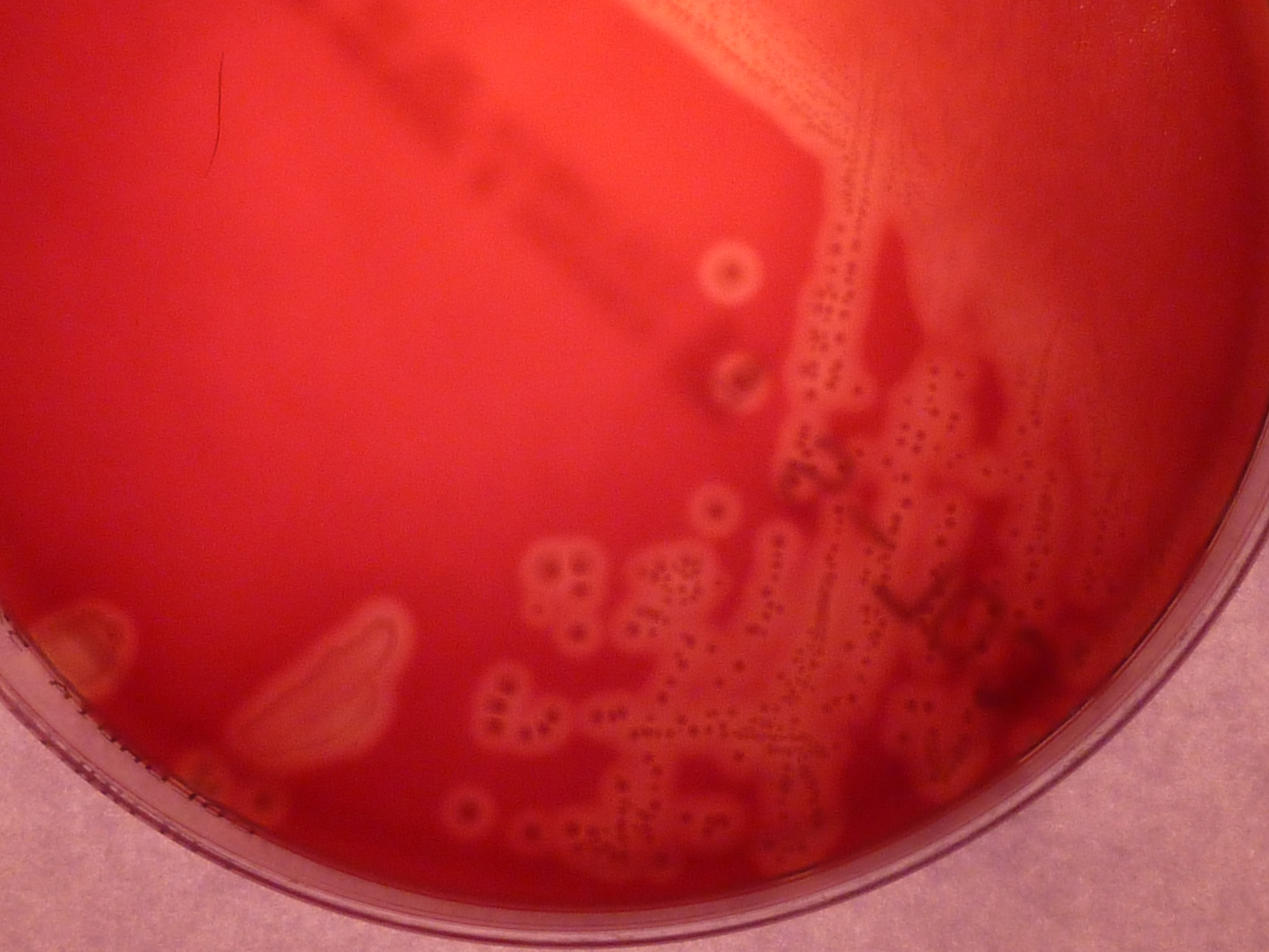 CAMP test showing half-moon shaped zone of complete hemolysis on a