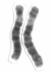 File:Human male karyotpe high resolution - Chromosome 6 cropped.png